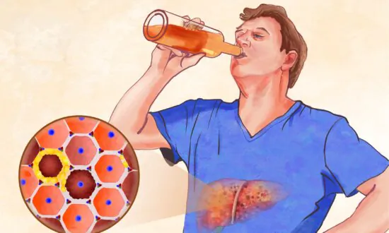 Cirrhosis: Symptoms, Causes, Treatments, and Natural Approaches
