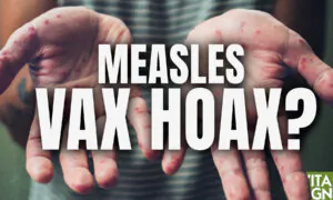 Did the MMR Vax Really End Measles in the US? How Do Vaxxed Kids Compare to Unvaxxed Kids in Health?