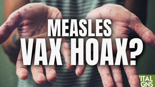 Did the MMR Vax Really End Measles in the US?