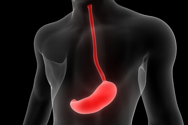 Popular Stomach Meds Linked to Stomach Cancer