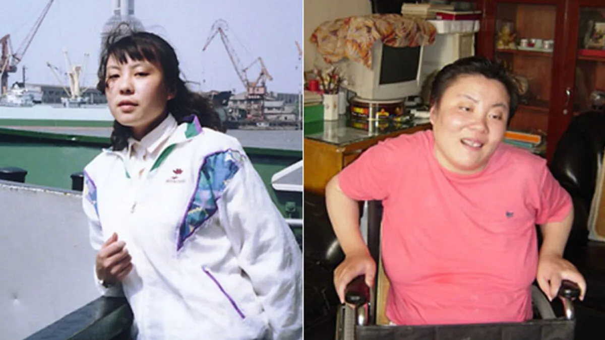 Zhu Ling, a talented student at Tsinghua University, was poisoned with the deadly chemical thallium in 1990s. (Courtesy of Help Zhuling Foundation)