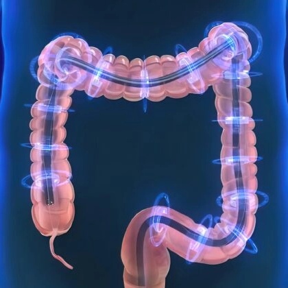 New Update About Colonoscopy