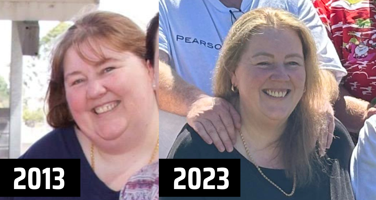 A before and after comparison of Ms. Barker.