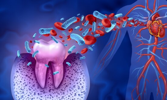Treating Gum Disease May Prevent Return of Irregular Heartbeat: Study