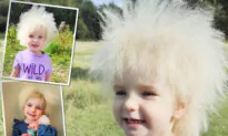 Girl With Frizzy Hair Nicknamed ‘Fluffy’ by Friends—She’s One of Only 100 People in the World With This Syndrome