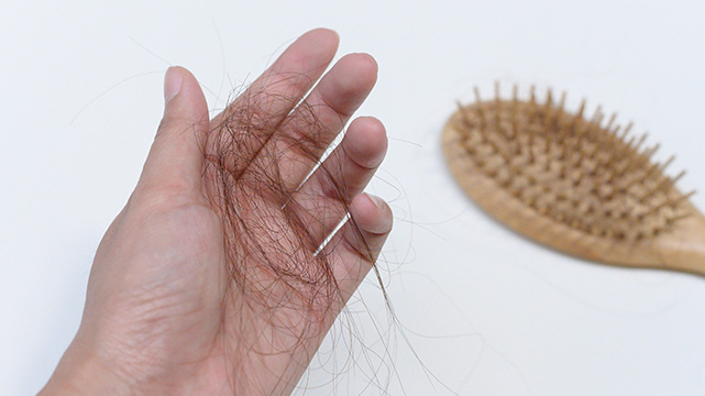 Everyday Hair Mistakes We Make Leading to Hair Loss, Dandruff & Split Ends