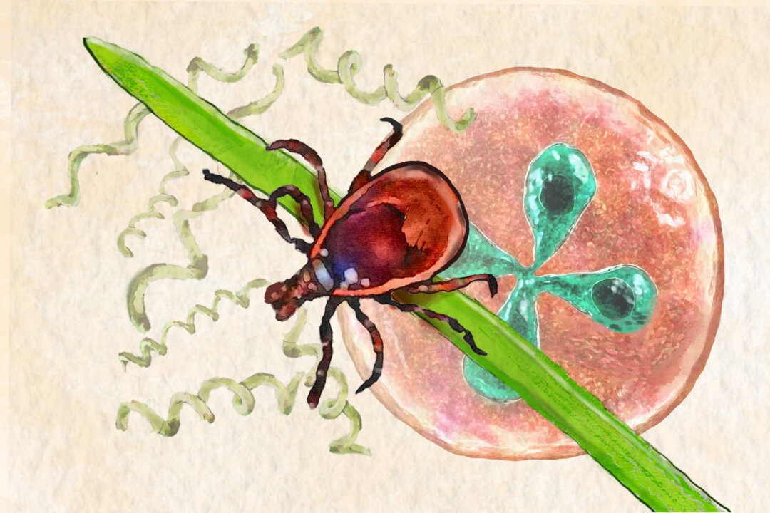 Tick - Borne Diseases: Symptoms, Causes, Treatments, and Natural Approaches