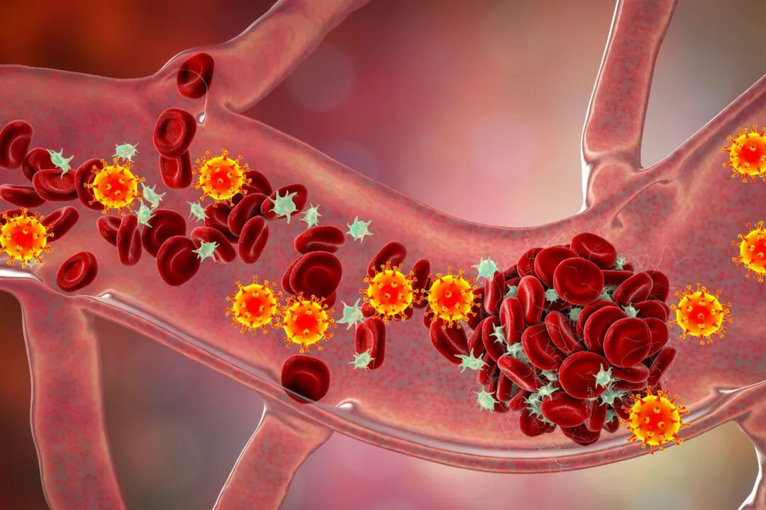 Older Man Who Had COVID-19 for 613 Days Developed New Variant