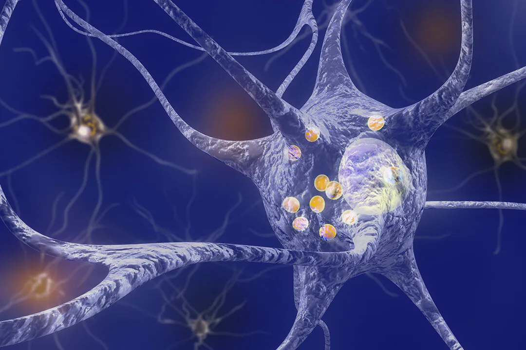 5 Focused Exercises to Help Manage Parkinson’s Disease