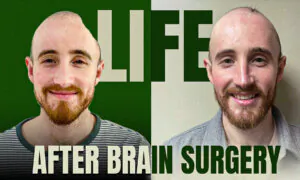 ‘Window to Brain’ ADVANCES Brain-Tumor, Brain Injury Treatment