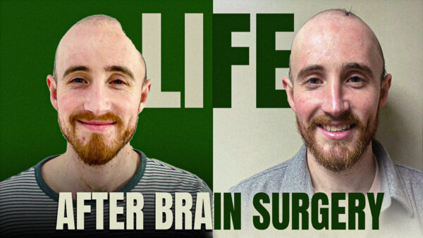 'Window to Brain' ADVANCES Brain-Tumor, Brain Injury Treatment