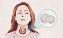 Hashimoto’s Thyroiditis: Watch for These Main Signs, 3 Natural Approaches
