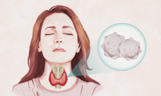 Hashimoto's Thyroiditis: Symptoms, Causes, Treatments, and Natural Approaches