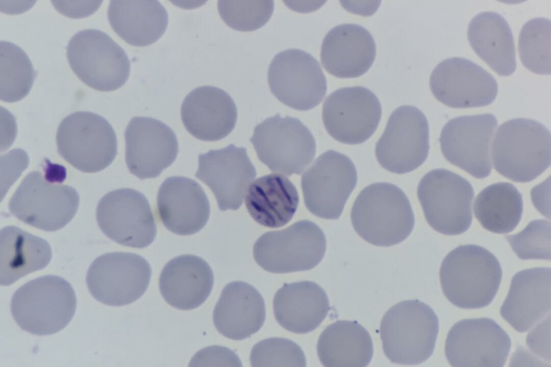 Southeastern Ontario Health Unit Probes 114 Cases of Parasitic Stomach Illness