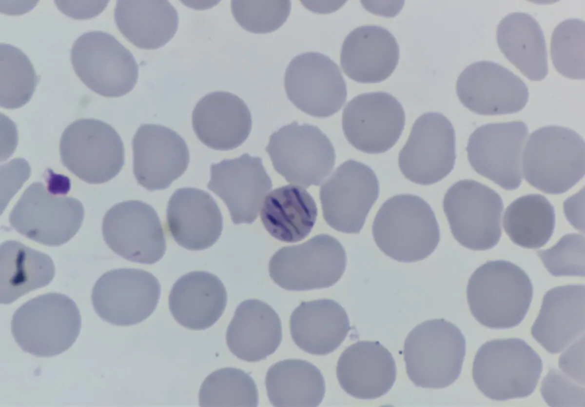 The Southeast Public Health Unit is looking into at least 114 cases of a stomach ailment referred to as cryptosporidiosis in the Kingston, Ont., region. (Kitsawet Saethao/Shutterstock)