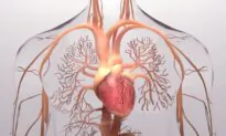 Avoiding Specific Foods May Enhance Pulmonary Hypertension Treatment