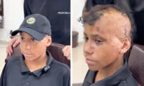 12-Year-Old Burn Victim Gets His ‘Hair’ Back After a Decade—Watch His Incredible Makeover: VIDEO