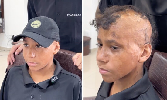 12-Year-Old Burn Victim Gets His 'Hair' Back After a Decade—Watch His Incredible Makeover: VIDEO