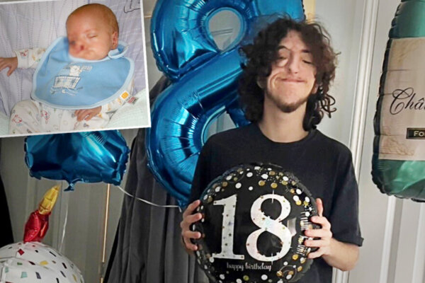 Mom Is Labeled 'Cruel' for Choosing Life for Her Son With a Rare Severe Cleft Lip, Now He's a Happy, Healthy 18-Year-Old