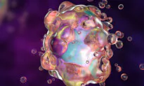 Research Suggests Unusual Form of Cell Death Causes Severe COVID-19 Lung Damage