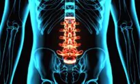 Chiropractic Care Reduces Opioid Prescriptions for Lower Back Pain by 68 Percent: Study