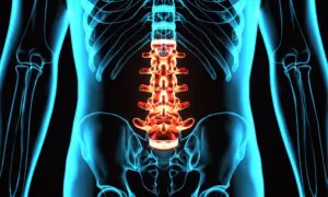 Chiropractic Care Reduces Opioid Prescription for Lower Back Pain by 68 Percent: Study