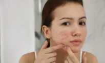 Rosacea Linked to Skin Cancer, Including Malignant Melanoma