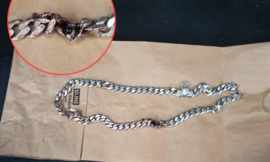 ‘Just Incredible’: Colorado Man’s Neck Chain Blocks Bullet From Gunshot, Saves His Life: Police