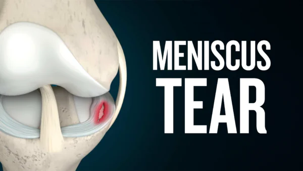 No Surgery: He Was Back Playing Soccer in 3 Weeks | Expert Talk with Dana Churchill, ND