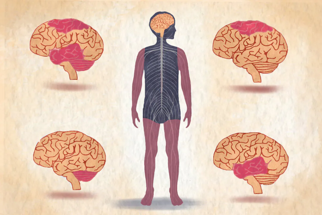 Cerebral palsy is a neurological condition caused by brain damage before, during, or right after a child's birth. (Illustration by The Epoch Times, Shutterstock)