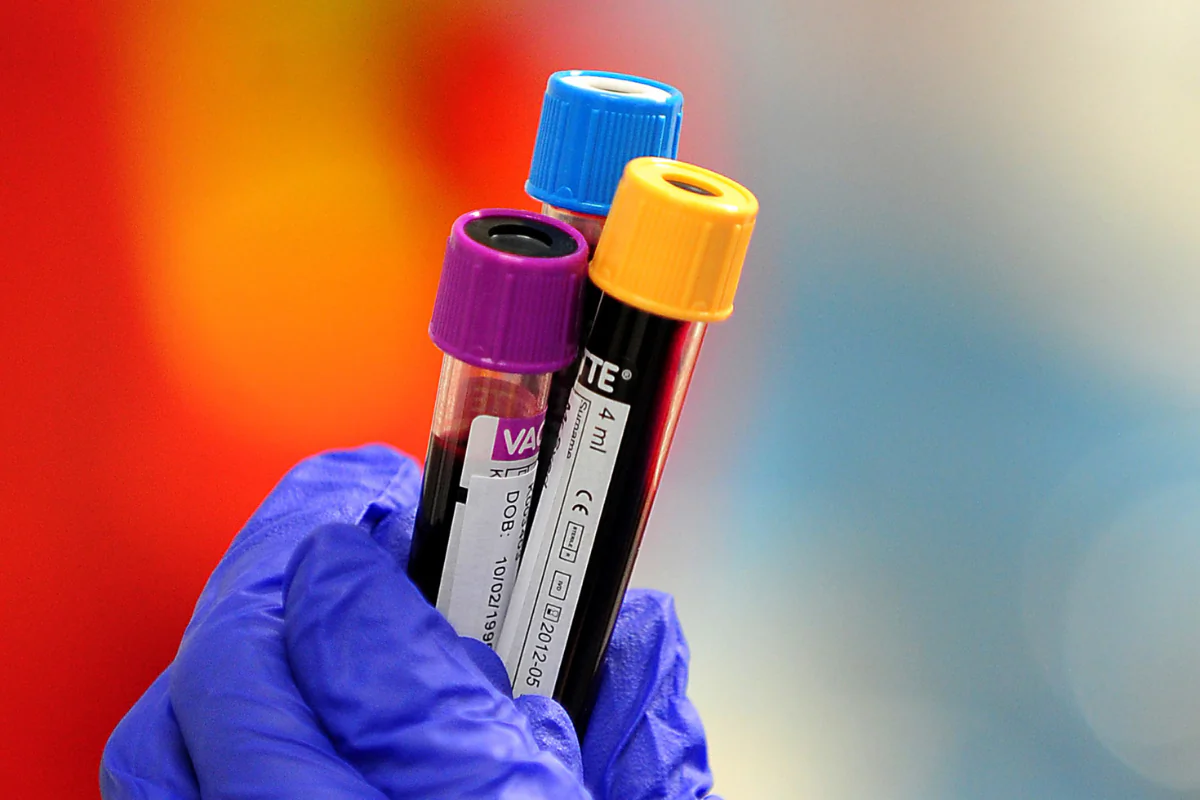 File photo of blood samples being held, dated April 7, 2011. (Vieira/PA Wire)