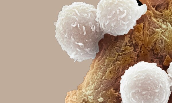 Cancer Cells 'Cooperate' to Survive, Study Finds