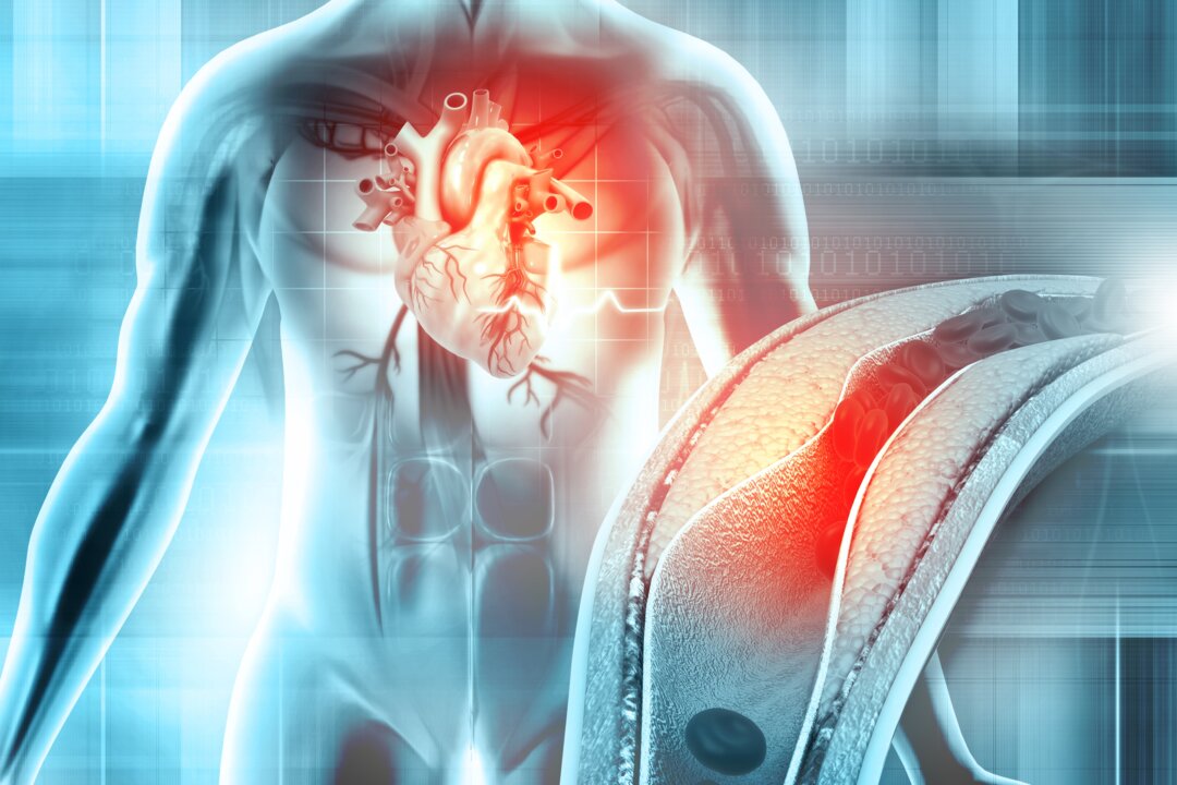 New Link Discovered Between Heart Disease and Cancer