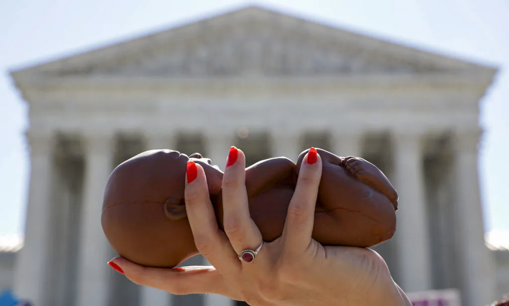 A pro-life activist holds a model fetus during a demonstration in front of the U.S. Supreme Court in Washington on June 29, 2020. (Alex Wong/Getty Images)