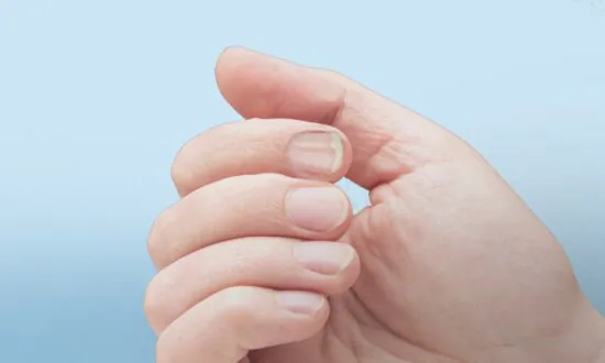 Fingernail Changes May Be Clues About Increased Cancer Risk