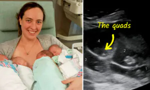 Mom Who Lost 4 Children Gives Birth to Rare Identical Quadruplets: ‘It Almost Felt Like Fate’