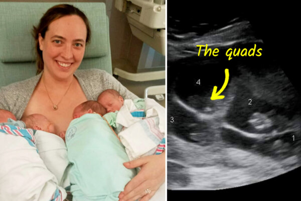 Mom Who Lost 4 Children Gives Birth to Rare Identical Quadruplets: 'It Almost Felt Like Fate'