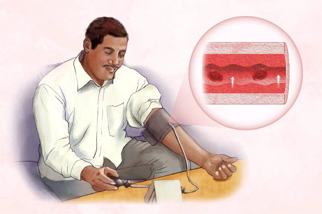 About half of American adults have hypertension, or high blood pressure. (Illustration by The Epoch Times, Shutterstock)