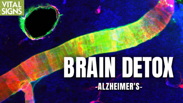 Can Alzheimer’s Brain Toxins Be Cleared?