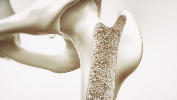 New Hormone Discovery Unlocks Hope for Osteoporosis Treatment