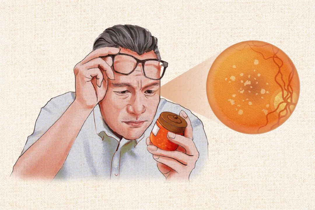 The most common type of macular degeneration is age-related. (Illustration by The Epoch Times, Shutterstock, Getty Images)