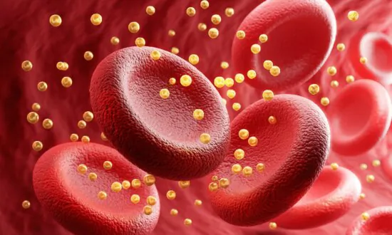 Study Challenges ‘Bad Cholesterol’ Label for LDL