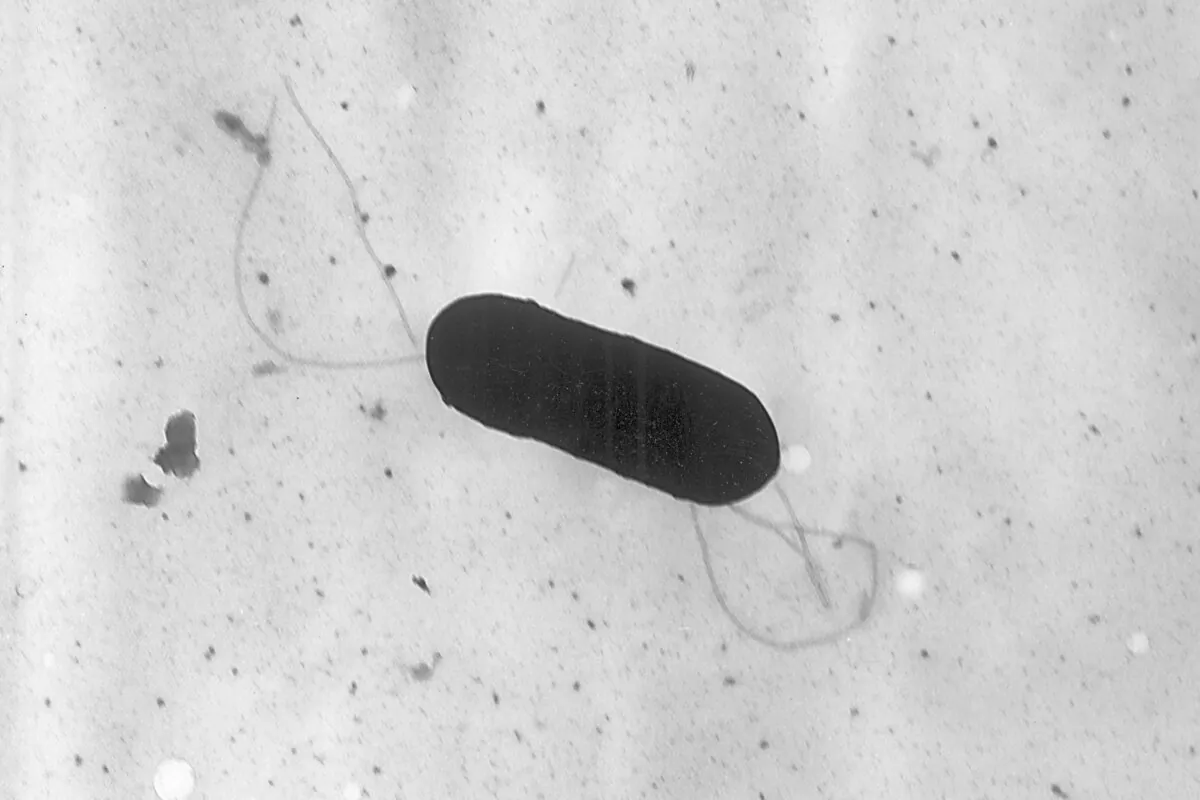 An electron microscope image made available by the Centers for Disease Control and Prevention shows a Listeria monocytogenes bacterium in a 2002 handout photo. (The Canadian Press/AP-HO, CDC, Elizabeth White)