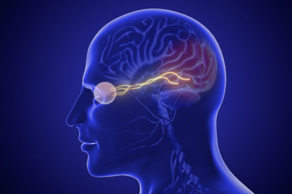 Common Eye Condition May Increase Risk of Dementia