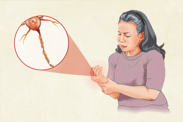 Peripheral Neuropathy: A Complex Disorder With 13 Main Causes