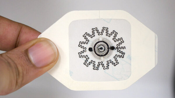 New Electric Bandage Accelerates Healing of Chronic Wounds: Study