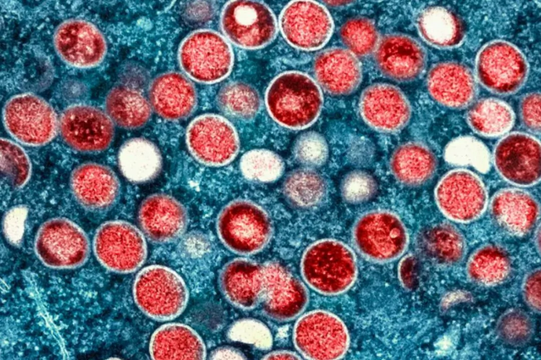 This photo shows an electron microscope image of mpox, or monkeypox, provided by the National Institute of Allergy and Infectious Diseases. (U.S. National Institute of Allergy and Infectious Diseases)
