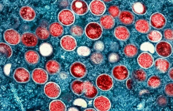 CDC Sends Virus Health Alert