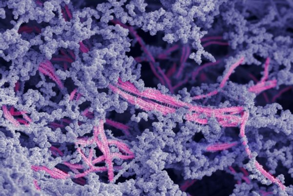 New Material May Regrow Damaged Cartilage in Joints