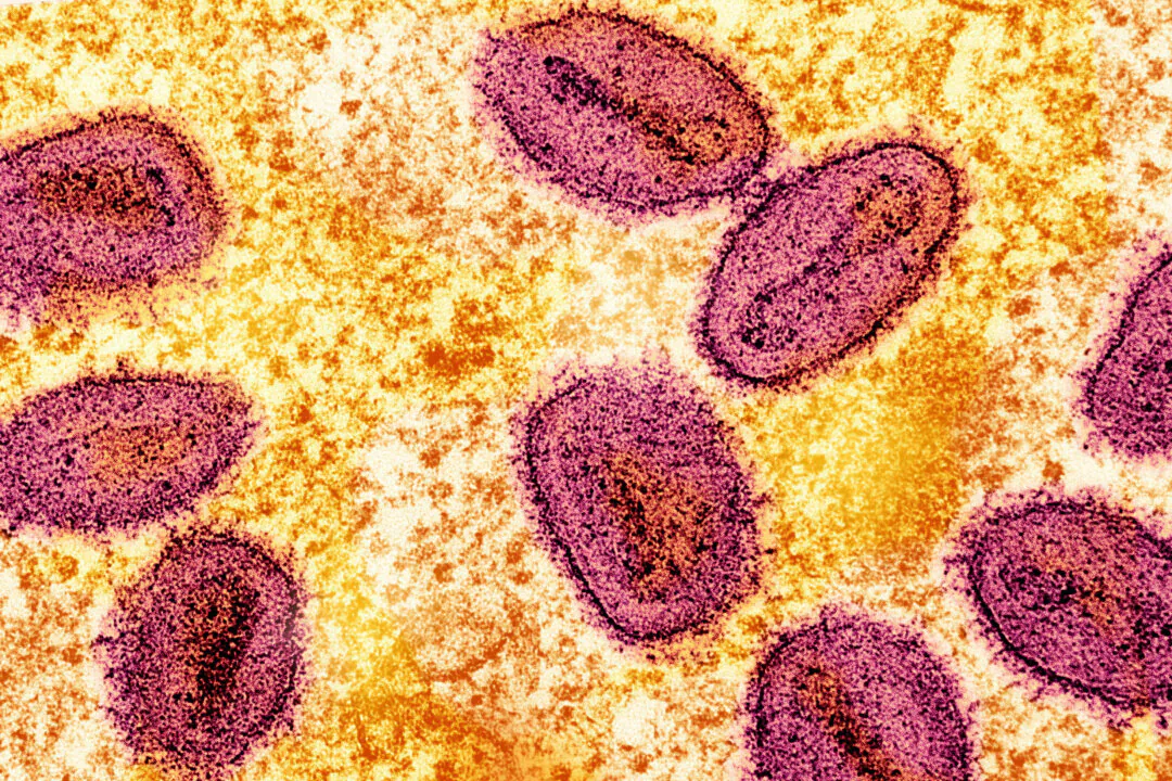 An undated colorized transmission electron micrograph of mpox virus particles (pink) found within an infected cell (yellow), cultured in the laboratory, captured at the National Institute of Allergy and Infectious Diseases (NIAID) Integrated Research Facility (IRF) in Fort Detrick, Md. (NIAID/Handout via Reuters)